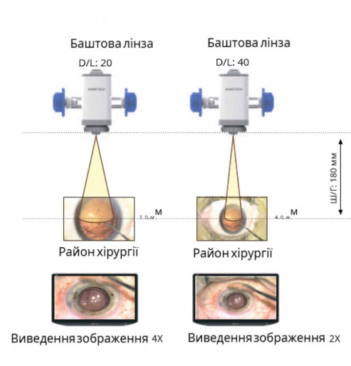 Цифровий офтальмологічний мікроскоп RealMicro VOMS-400 4K 3D