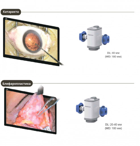 Цифровий офтальмологічний мікроскоп RealMicro VOMS-400 4K 3D
