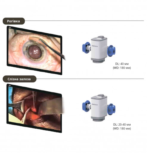 Цифровий офтальмологічний мікроскоп RealMicro VOMS-400 4K 3D